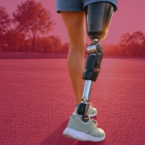 Prosthetic leg in use during walking for improved mobility and independence