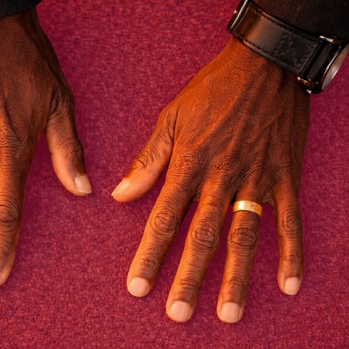 Close-up of prosthetic hands showing realistic design and function